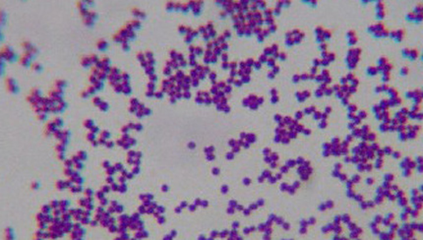 <p>Gram positive cocci arranged in grape-like clusters </p>