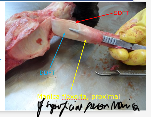 <ul><li><p>only 1</p></li><li><p>a small ring of SDFT which wraps around DDFT in proximal part of digital flexor sheath </p></li></ul><p></p>