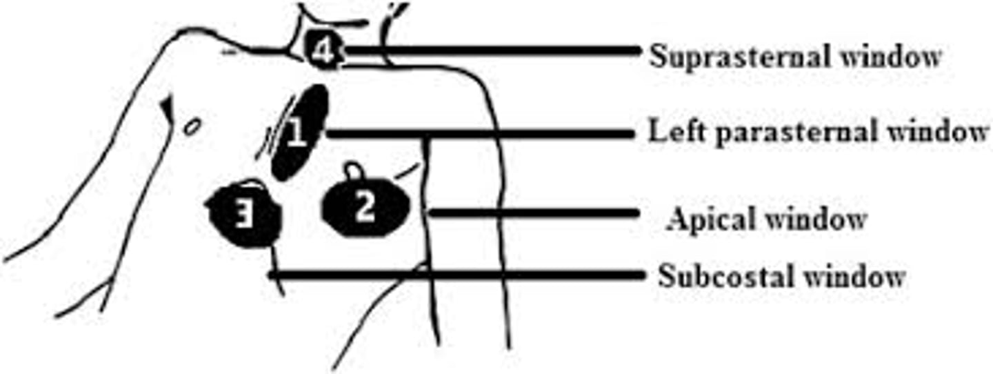 <p>C. Right sternal border</p>
