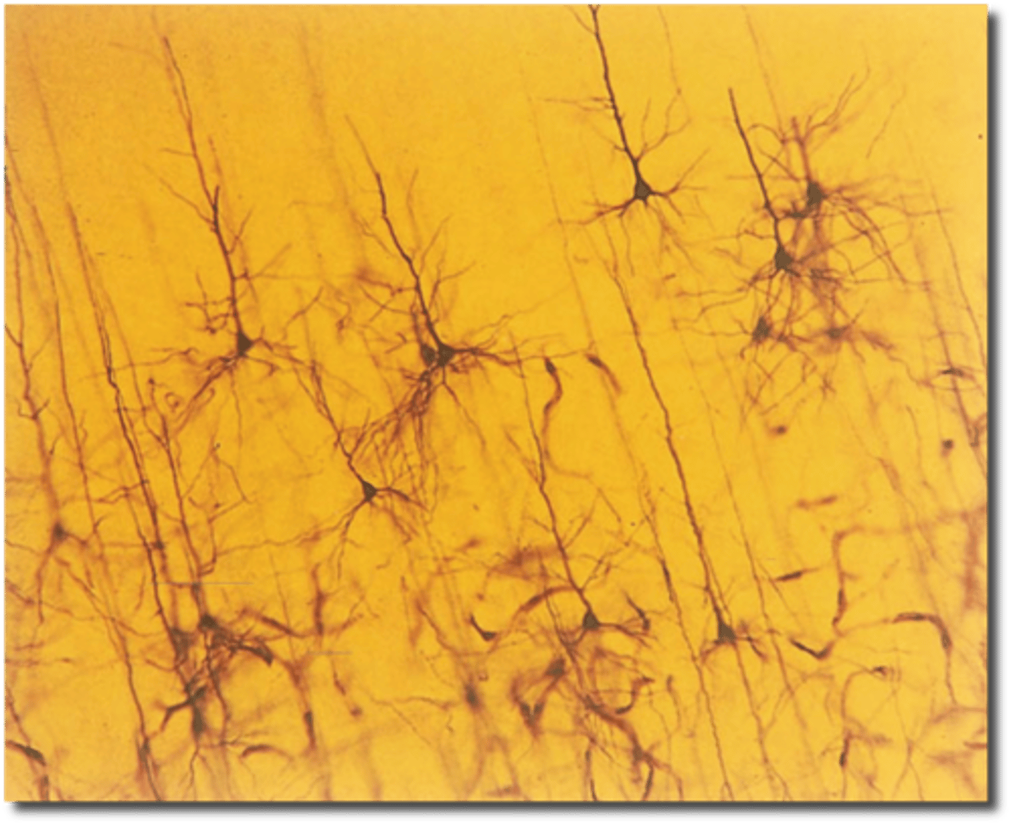 <p>Histological technique that labels a small amount of neurons in a sample but stained cells are stained completely, revealing fine details</p>