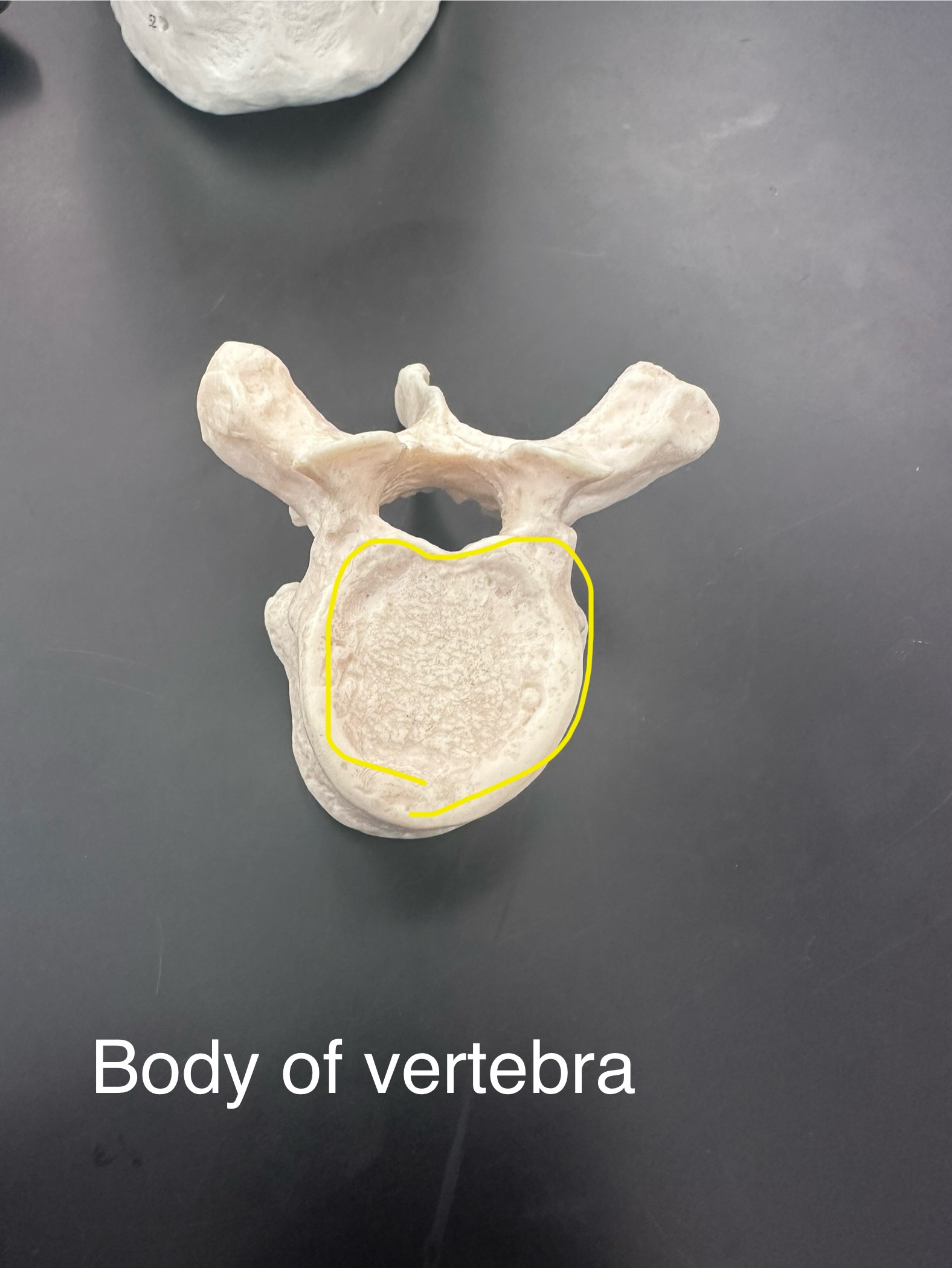 <p>Body of vertebra</p>