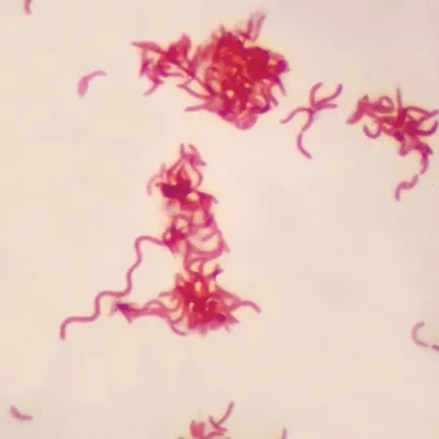 <p>(6) What shape is this bacteria?</p>