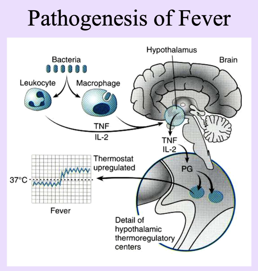 <p>Inflammation Clinicopathologic Correlation</p>