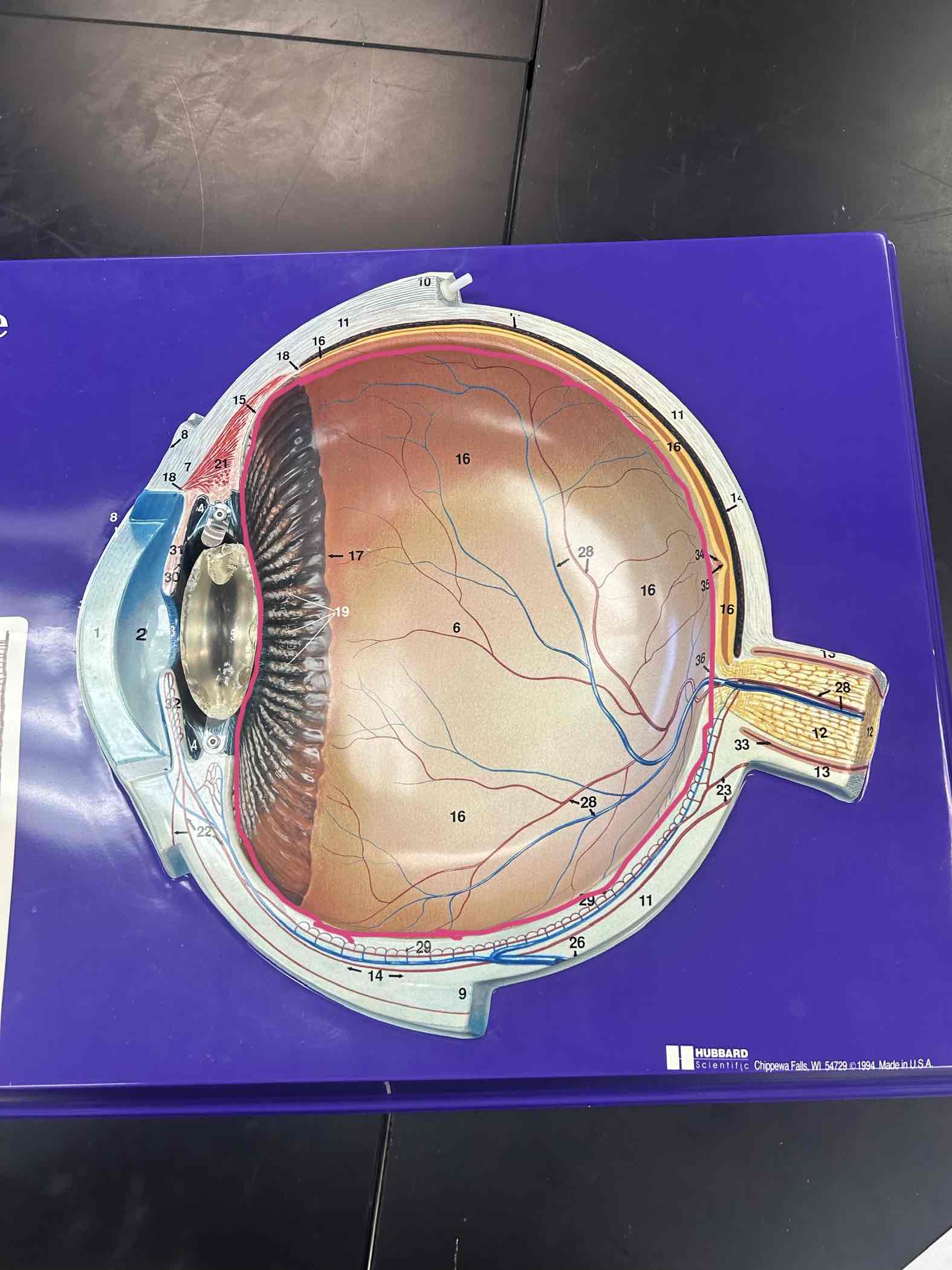 <p>Posterior cavity to the lens</p>