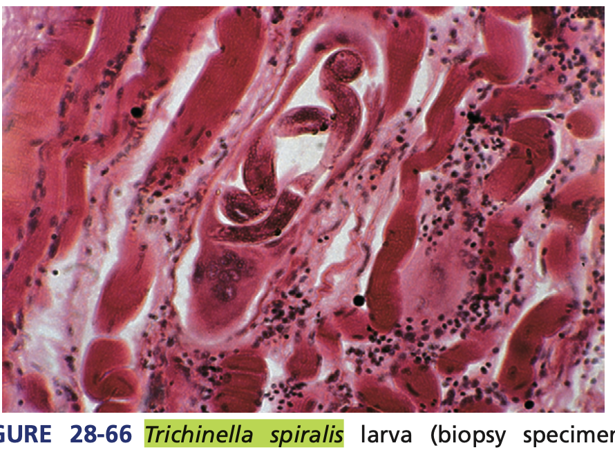 <p>A nematode parasite.</p>