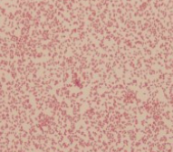 <p>what type of bacteria is this</p>