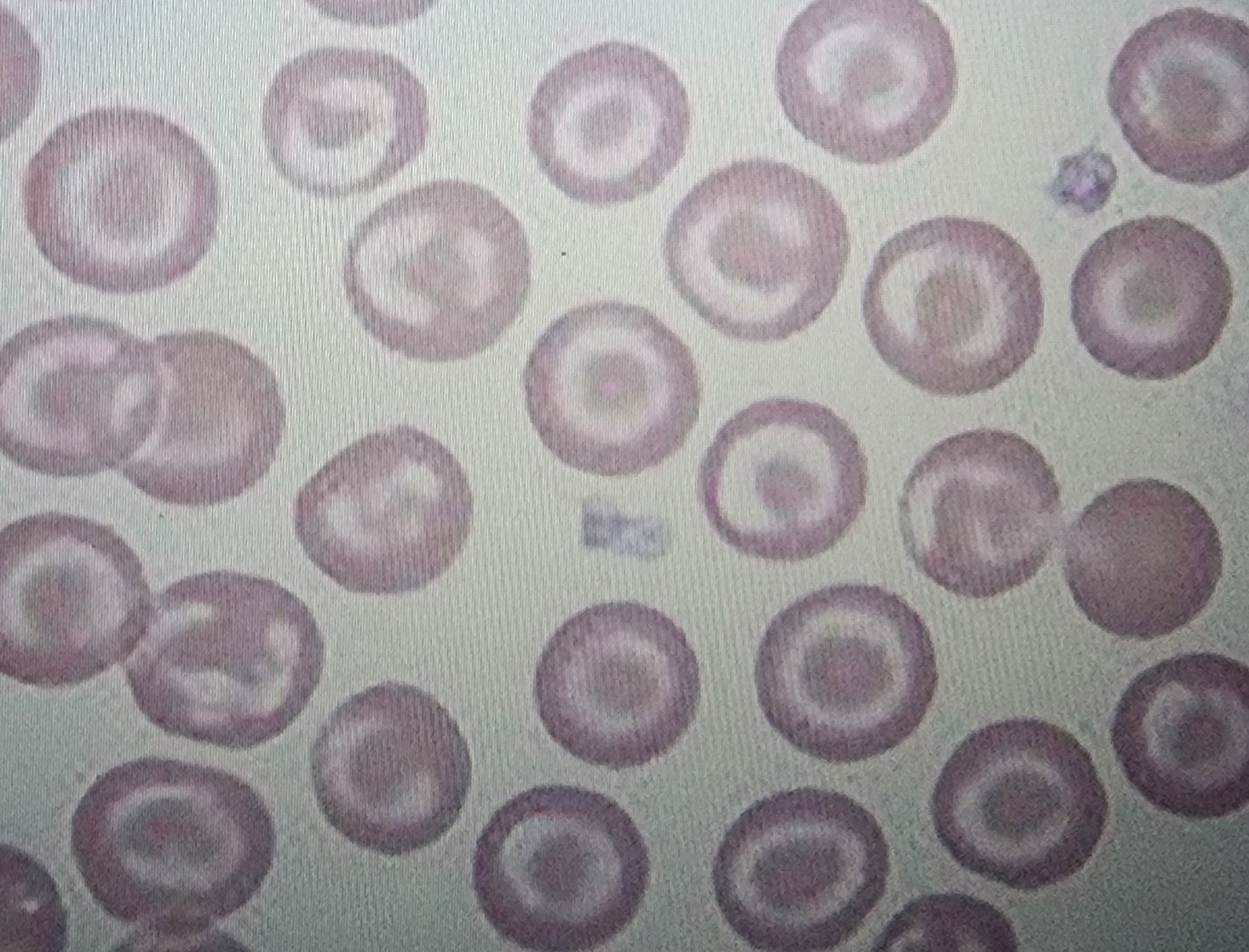 <p>Target cells</p>