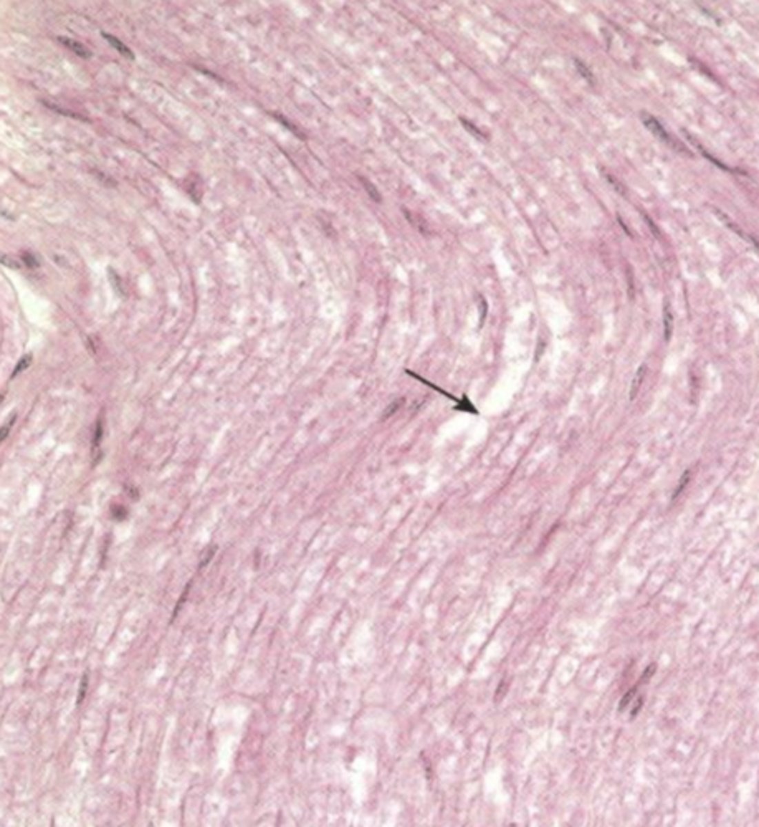 <p>if this is a peripheral nerve, what is this flat cell?</p>