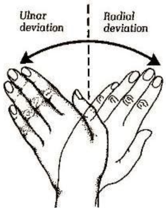 <p>Radial deviation</p>