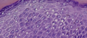 <p>Stratum spinosum</p>