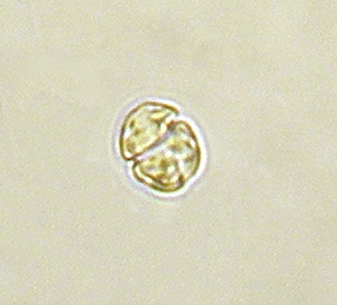 <p>marine dinoflagellate</p>