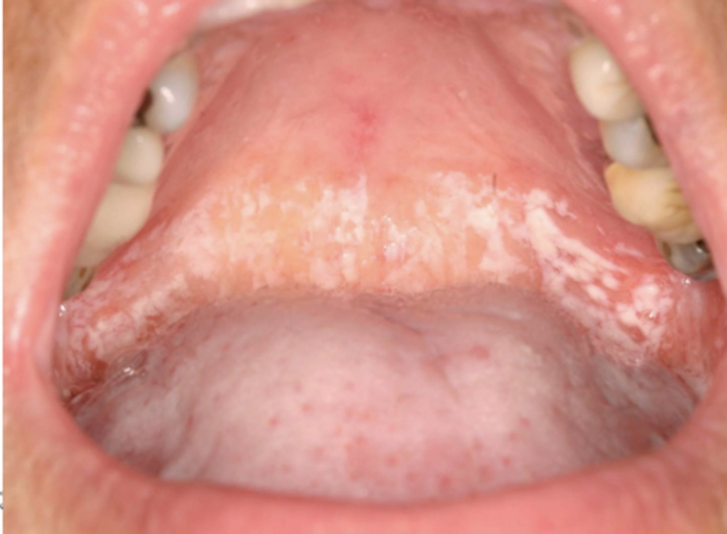 <p>What condition?</p>