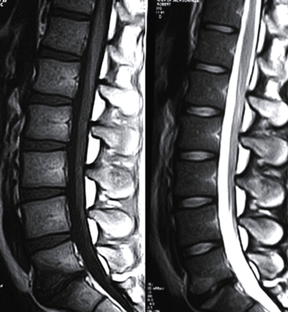 <p>What plane is this MRI?</p><p>a. sagittal</p><p>b. coronal</p><p>c. axial</p><p>d. AP</p>