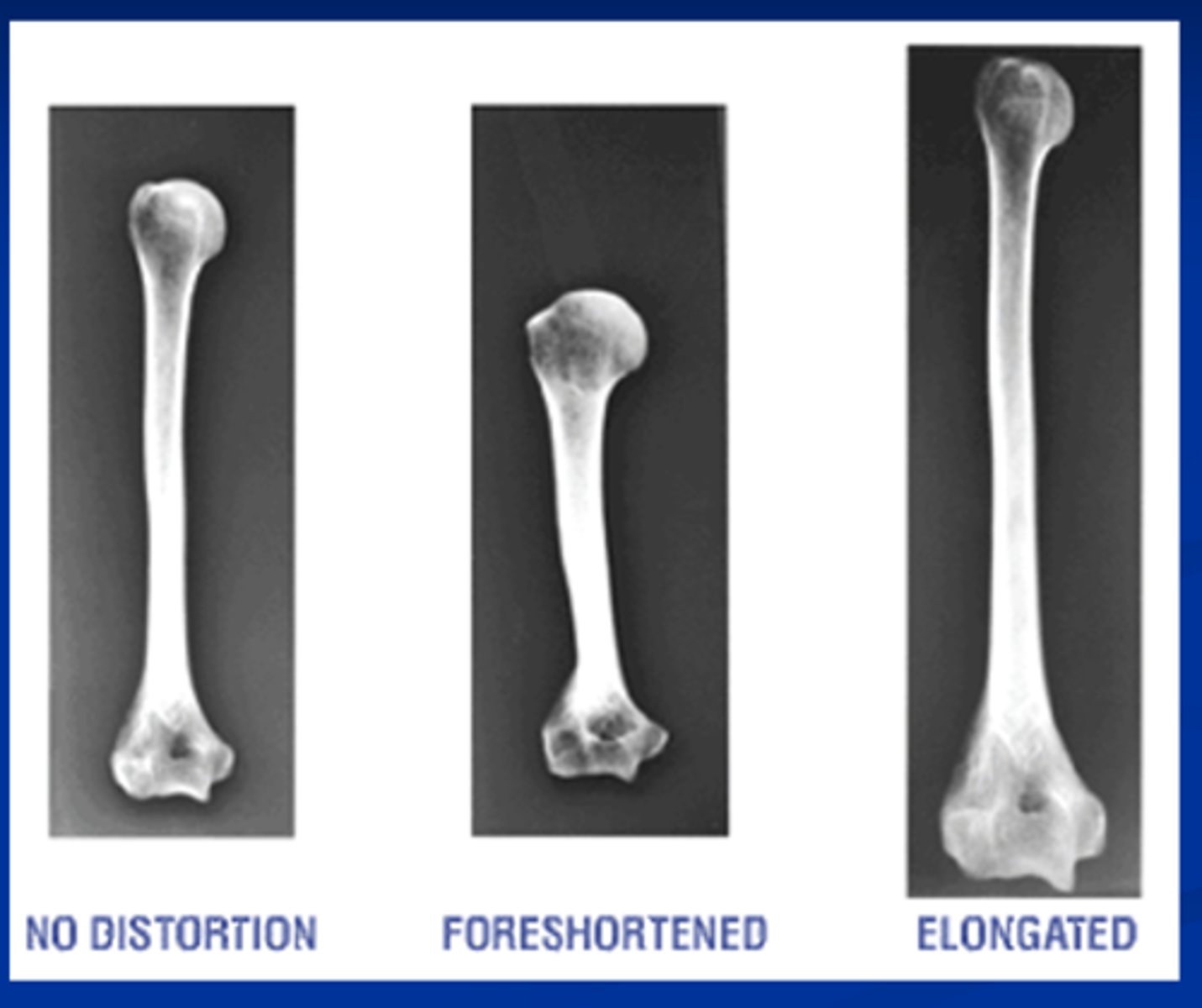 <p>-elongation &amp; foreshortening</p><p>-IR , X-ray tube, anatomical part</p>