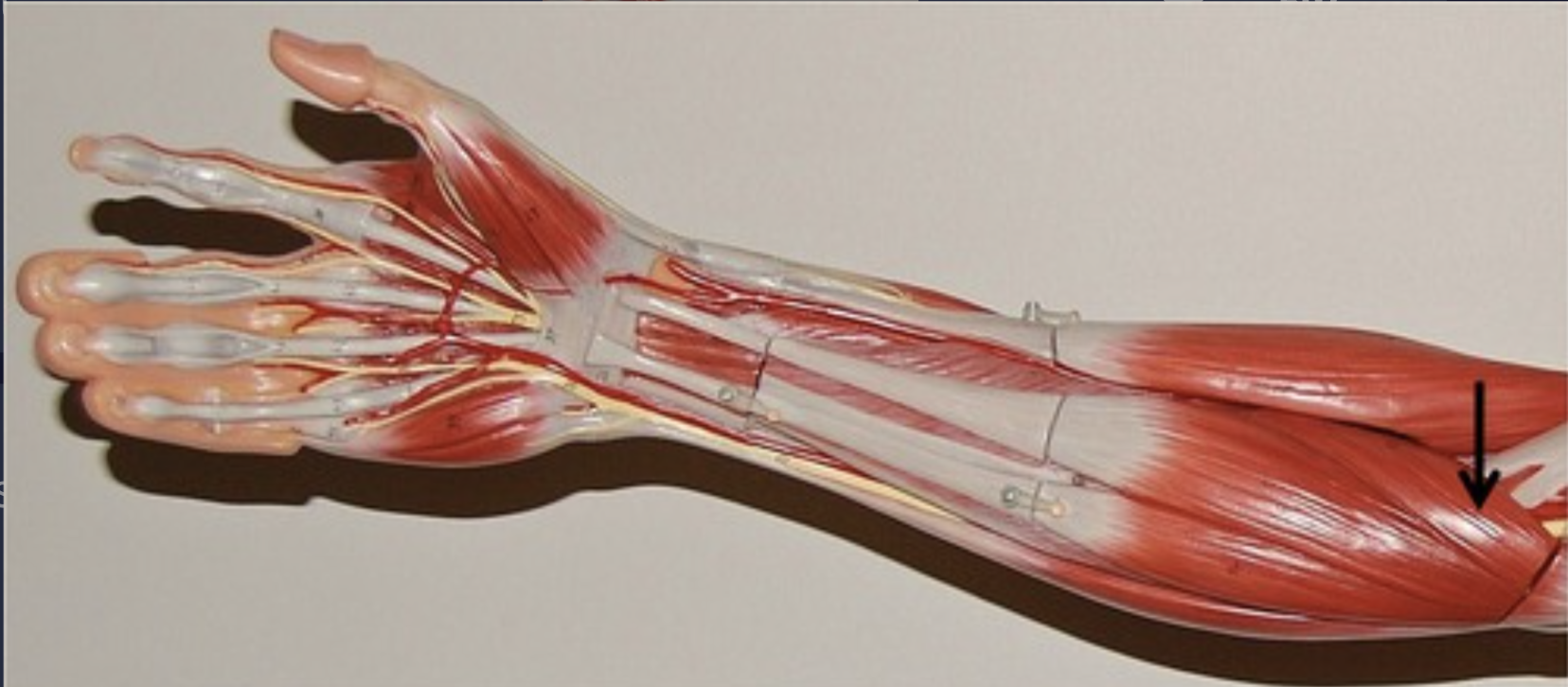 <p>What muscle is this?*****</p>