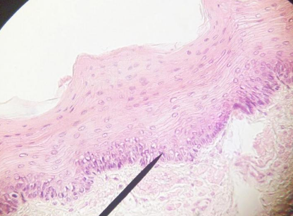 <p>Name this tissue</p>