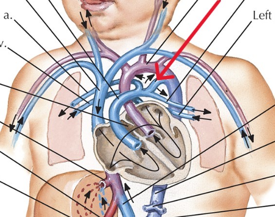 <p>Which vessel of heart:</p><ul><li><p>Lets blood pass from <u>pulmonary trunk to aorta</u></p></li></ul><p></p>