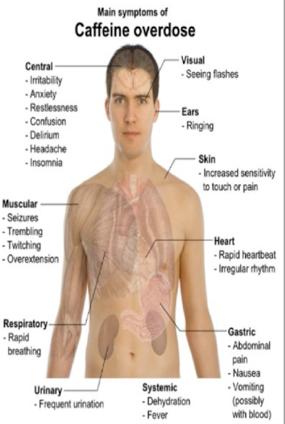 <ul><li><p>occurs when too much caffeine consumed</p></li><li><p>symptoms</p><ul><li><p>fatal overdoses rare but exist</p></li><li><p>minor symptoms: dizziness, dhiarrhea, increased thirst, insomnia, headache, fever, irritability</p></li><li><p>major symptoms: trouble breathing, vomitting, hallucinations, confusions, chest pain, irregualr or fast heartbeat, uncontrollable muscle movments, convulsions, shock</p></li></ul></li><li><p>caffeine sensitvity</p><ul><li><p>some ppl experience greater sensitivity than someone who consumes caffeine daily </p></li></ul></li></ul><p></p>
