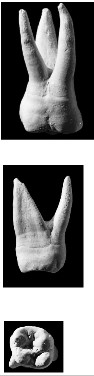 <p>Which tooth is this?</p>