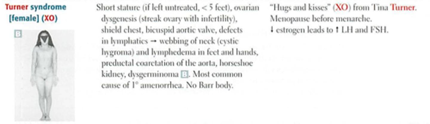 <p>Bicuspid aortic valve</p><p>Coarctation of the aorta</p><p>Aortic root dilation -> INC risk aortic dissection</p>