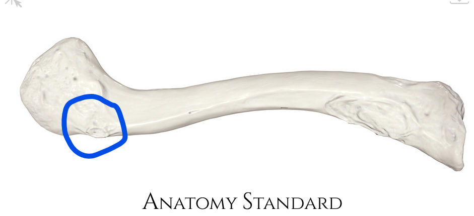 <p>Where the clavicle contacts the coracoid process on the scapula</p>