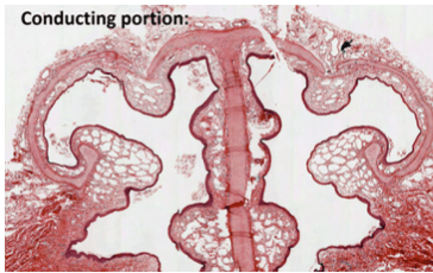<p>hyaline cartilague</p><p>OBSERVE THERE ARE MANY SPACES. THEY ARE VASCULAR SPACES. Their function is to warm up the</p><p>incoming air so it more or less resembles body temperature.</p><p>* Their function is to warm up the</p><p>incoming air so it more or less resembles body temperature.</p><p>* We find Goblet cells along the whole respiratory epithelium, down til the point where they</p><p>begin to be replaced by Clara cells, EXCEPT in olfactory epithelium. Serous glands = more</p><p>probable to be found in the nasal cavity</p>