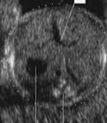 <p>what is the top line pointing at?</p>