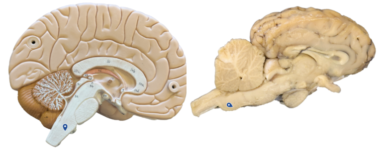 <p>What structure is the arrow pointing to?</p>