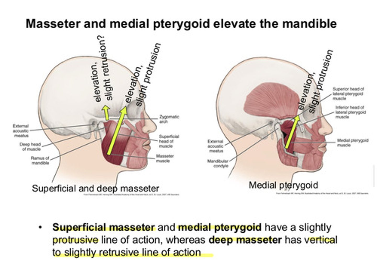 <p>masseter and medial pterygoid both have a slightly protrusive line of action, whereas deep masseter has vertical to slightly retrusive line of action</p>