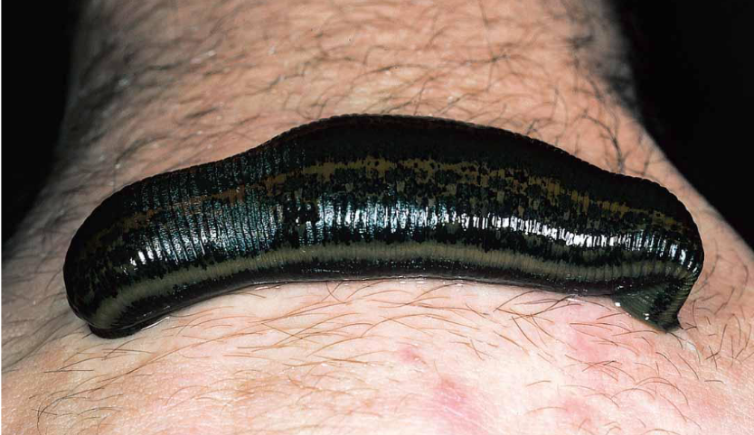 <p>Hirudo medicinalis, leech that is used when fingers or toes are severed to clear out congestion so the veins can grow back</p>