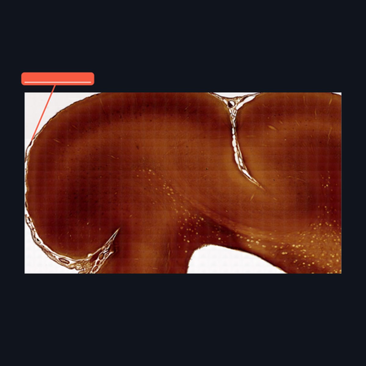 <p>What covers this structure of the brain?</p>