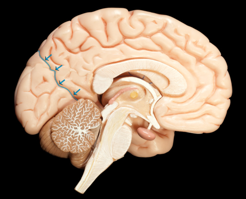 <p>what internal crevis SLICES the parietal lobe and occipital lobe</p>