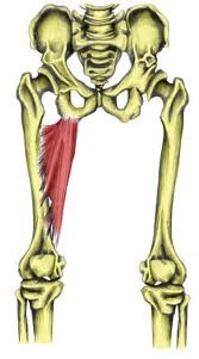 <p>adduction of hip</p>