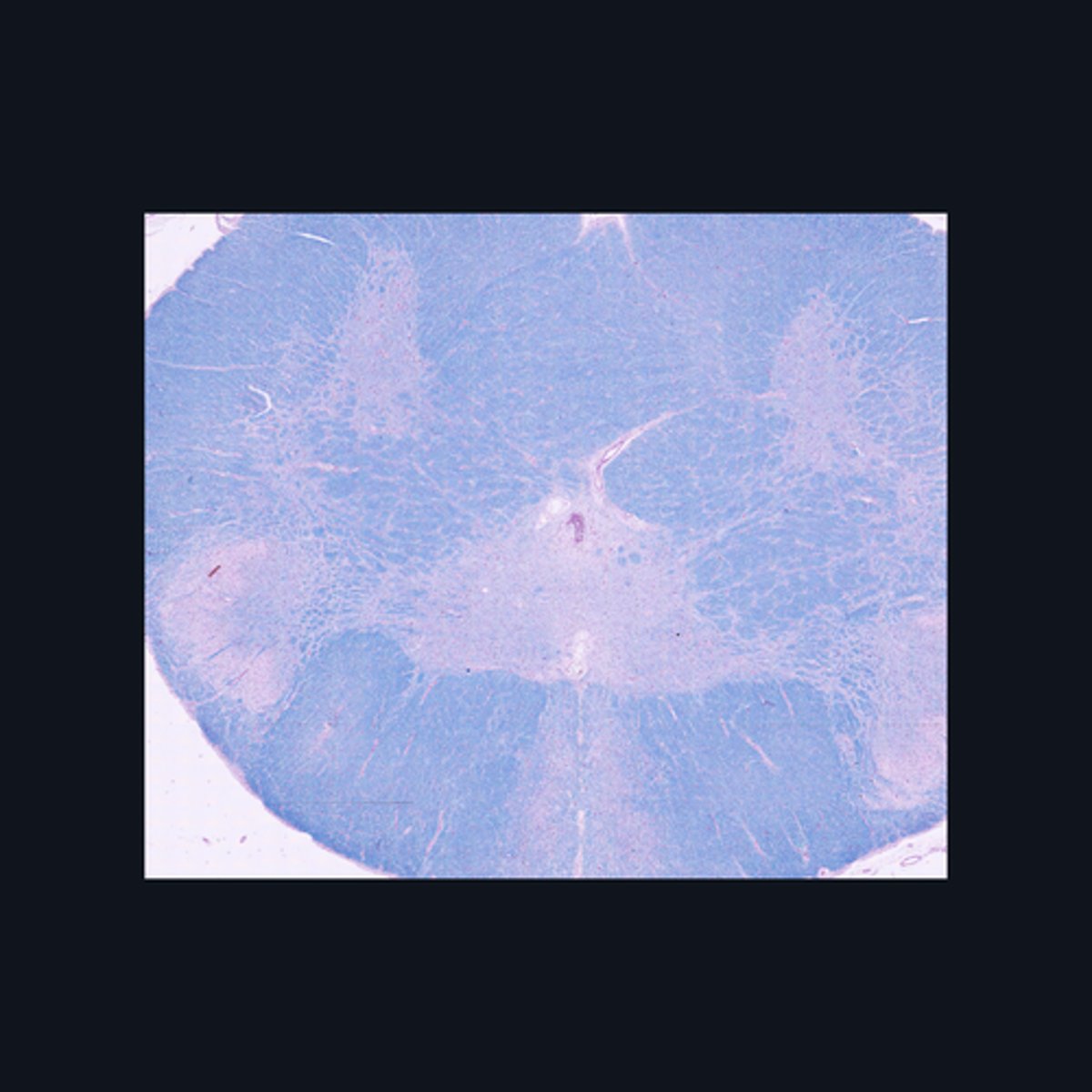 <p>Identify the region of the spinal cord in the given image.</p>