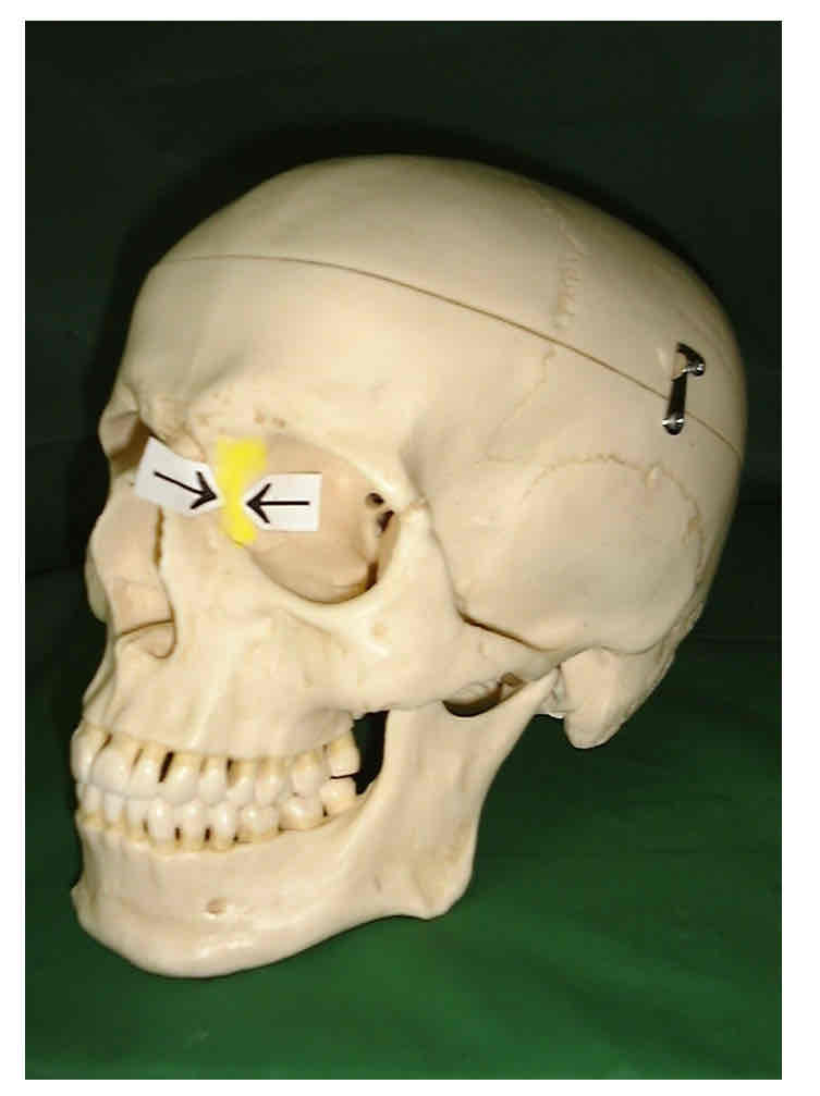 term image