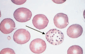 <ul><li><p><strong>lead poisoning</strong></p></li><li><p>small, dark blue bodies</p></li><li><p>from residual RNA</p></li><li><p>common in immature ruminant RBC’s</p></li><li><p>can be seen in anemic cats</p></li></ul><p></p>