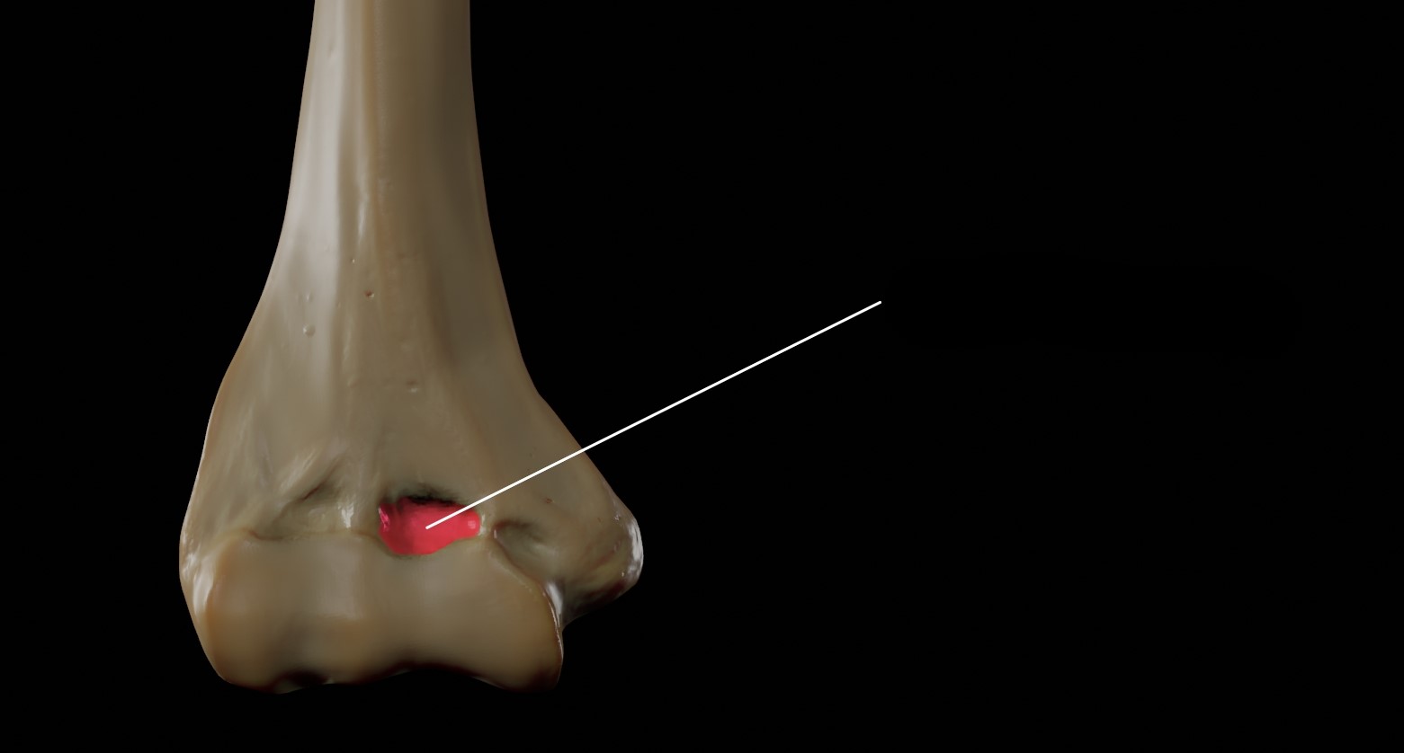 <p>Slight depression at the distal end of the humerus on the <strong>anterior side</strong></p><p>Superior to the Trachlea</p>