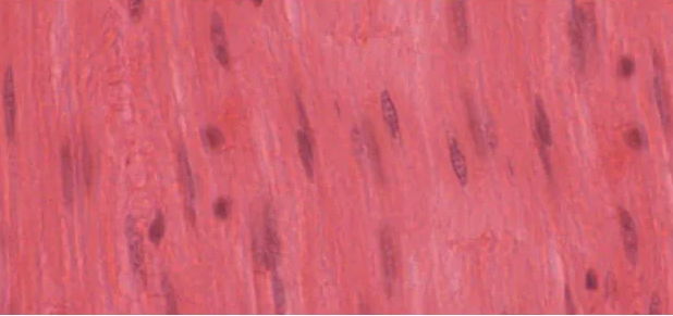 <p>appears smear like, single nucleus in each fiber </p>