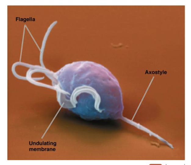<ul><li><p>reproductive protozoal disease</p></li><li><p>cause: <em>Trichomonas vaginalis</em></p></li><li><p>transmission: sexually</p></li><li><p>symptoms: infects urogenital tract of both males and females</p><ul><li><p>males: asymptomatic</p></li><li><p>female: irritation and profuse frothy, greenish-yellow, foul odor discharge</p></li></ul></li><li><p>unique: other species of <em>Trichomonas</em> are normal commensals</p></li></ul><p></p>