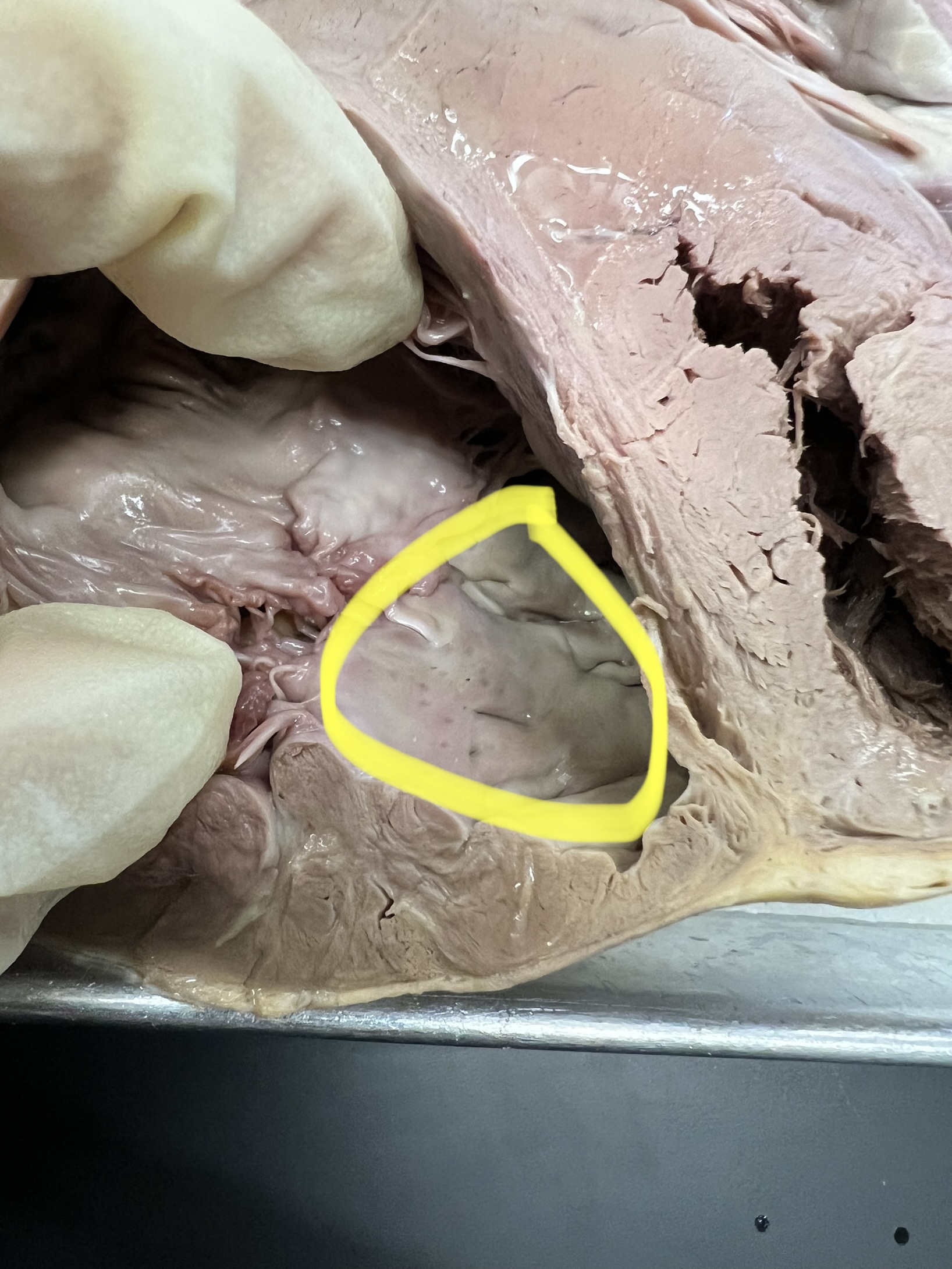 Name the heart structure.