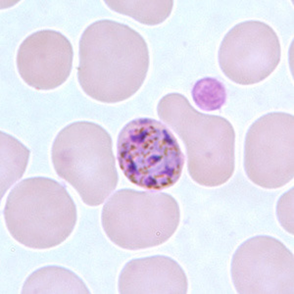 <p>*6-12 merozoites with large nuclei<br>*clustered around a mass of coarse dark-brown pigment<br>*sometimes arranged in a rosette pattern</p>