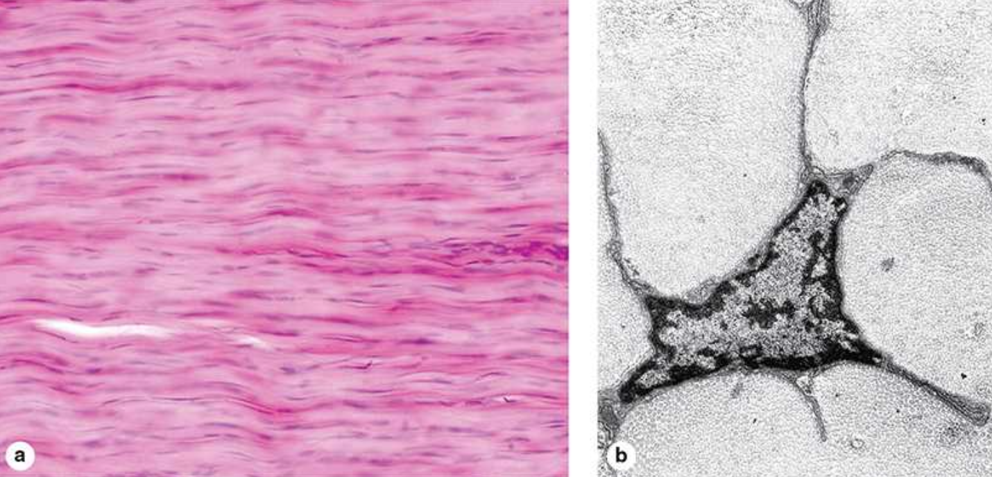 <p><span><span>What is dense regular connective tissue?</span></span></p>