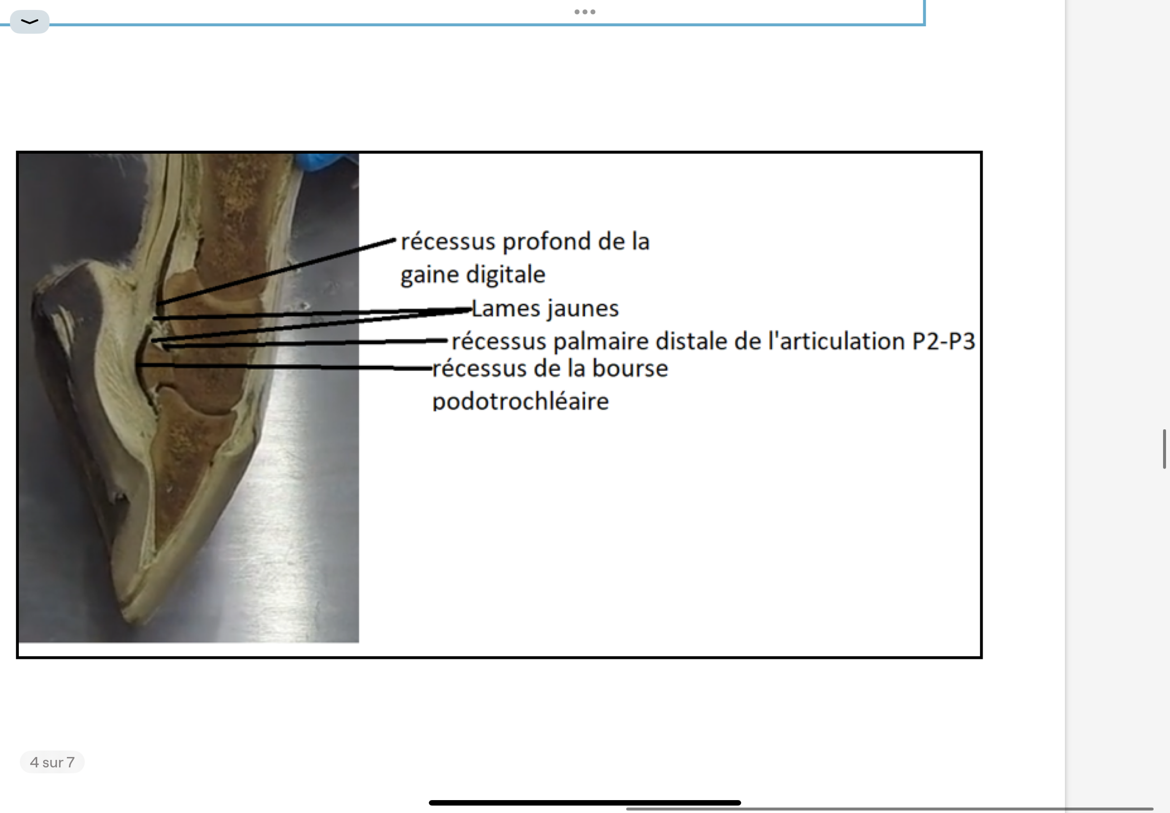 <p>La lame jaune = expansion du tendon du fléchisseur profond ( forme un T ligament du tendon du fléchisseur profond) s’insère sur l’os naviculaire (bord proximal) et sur P2 (face palmaire)</p><p>La lame jaune sépare 3 récessus (de 3 types différents) :</p><p>‣ Récessus (proximal)de la bourse podotrochléaire = synoviale tendineuse vésiculaire</p><p>‣ Récessus distal de la gaine digitale = synoviale</p><p>tendineuse vaginale</p><p>‣ Récessus palmaire distal de l'articulation P2-P3 = synoviale articulaire</p>