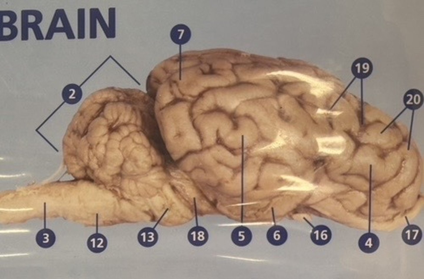 <p>What is number 19?</p>