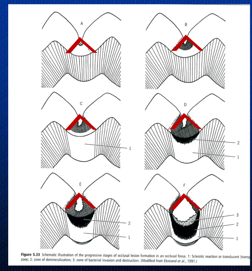 <p>inverted V</p>