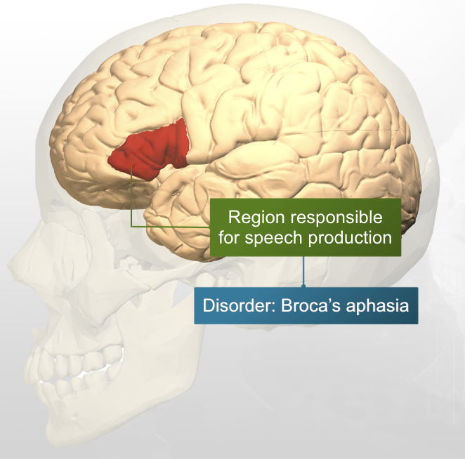 <p>The left, lateral portion of the frontal lobe.  </p>