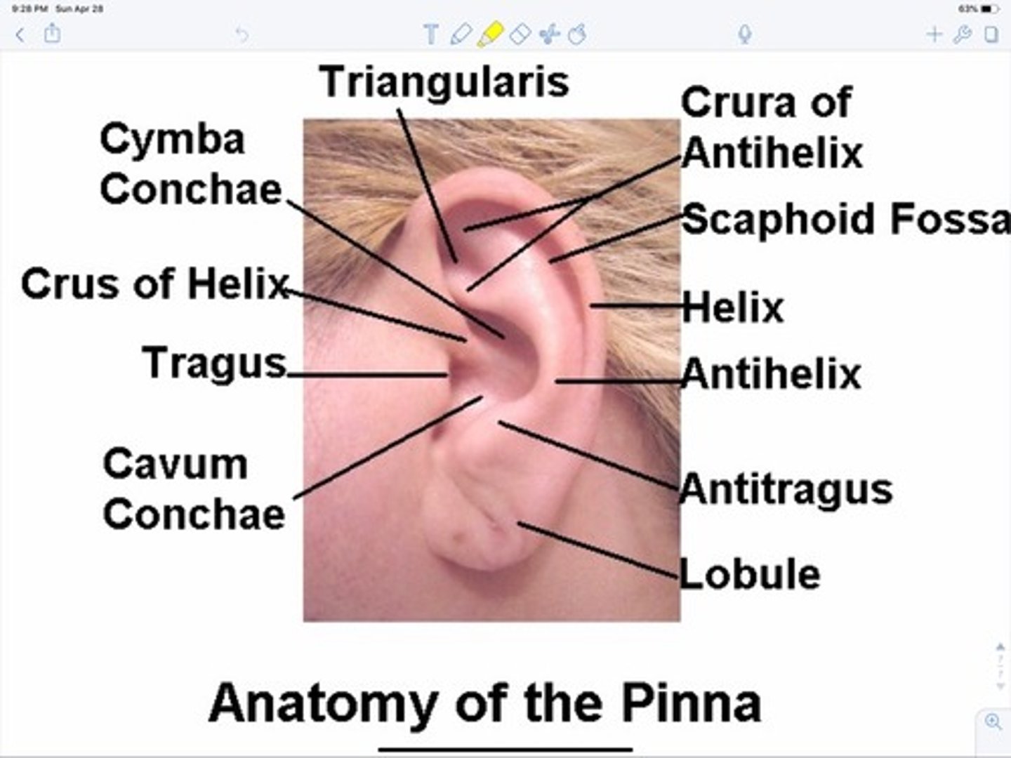 <p>visable, cartiligenous part of the ear</p>
