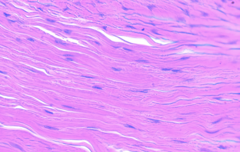 <p>Connective tissue proper with both collagen and elastic fibers that dissipate forces to bones.</p>