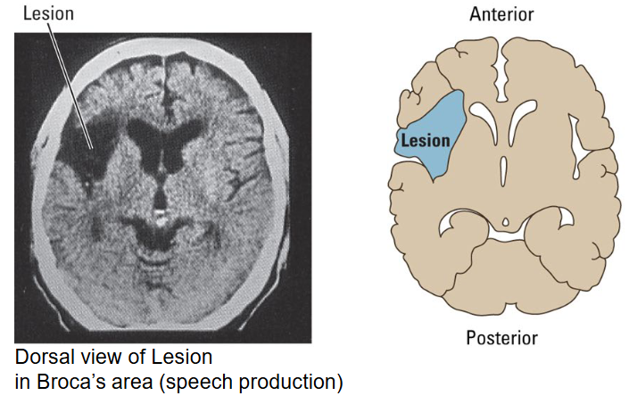 <p>It is appropriate for localizing <span style="color: red">bone fractures, brain tumors and lesions</span>.</p><ul><li><p><span style="color: red">Low temporal resolution (~1sec)</span></p></li><li><p><span style="color: #24ef0c">High spatial resolution (~1mm)</span></p></li></ul><p></p>