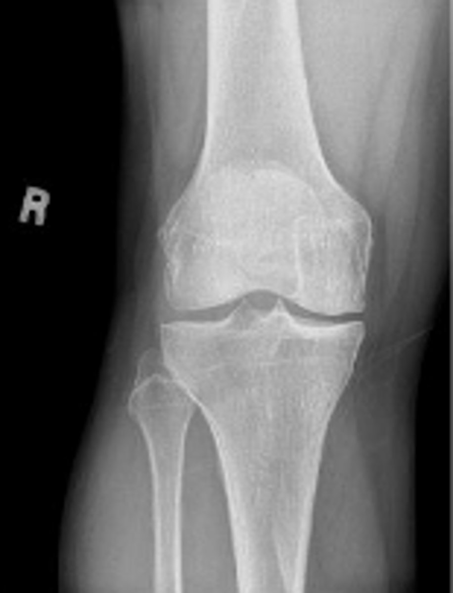 <p>What is the name of the radiographic view?</p>